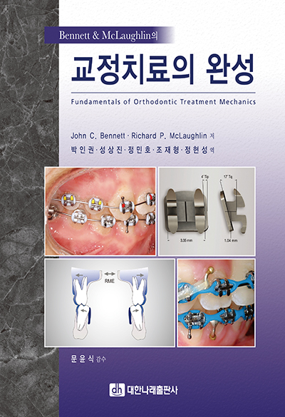 교정치료의 완성